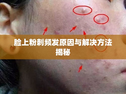 脸上粉刺频发原因与解决方法揭秘
