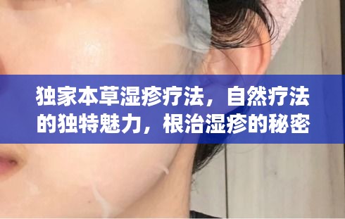 独家本草湿疹疗法，自然疗法的独特魅力，根治湿疹的秘密武器
