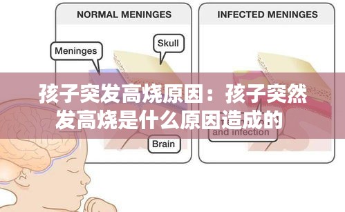 孩子突发高烧原因：孩子突然发高烧是什么原因造成的 