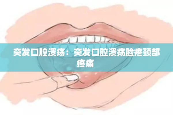 突发口腔溃疡：突发口腔溃疡脸疼颈部疼痛 