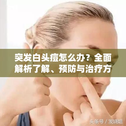 突发白头痘怎么办？全面解析了解、预防与治疗方案
