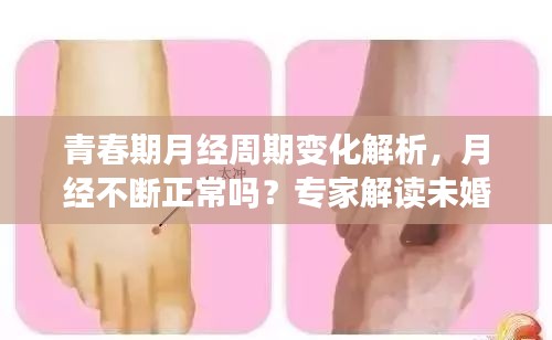 青春期月经周期变化解析，月经不断正常吗？专家解读未婚女性的生理奥秘！