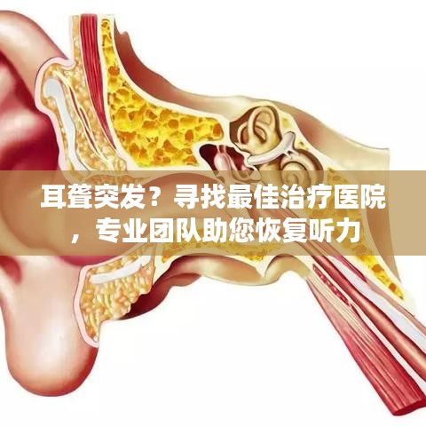 耳聋突发？寻找最佳治疗医院，专业团队助您恢复听力