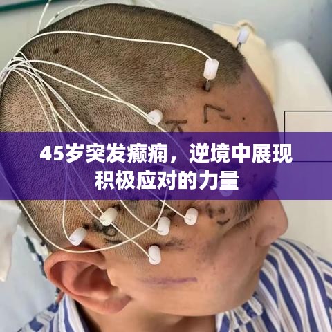 45岁突发癫痫，逆境中展现积极应对的力量