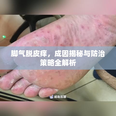 脚气脱皮痒，成因揭秘与防治策略全解析
