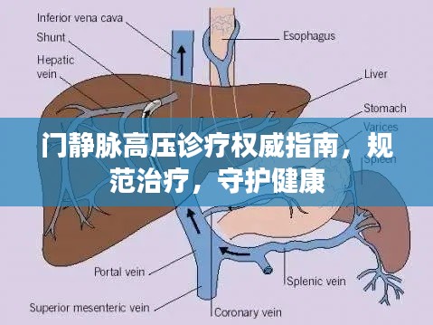 门静脉高压诊疗权威指南，规范治疗，守护健康