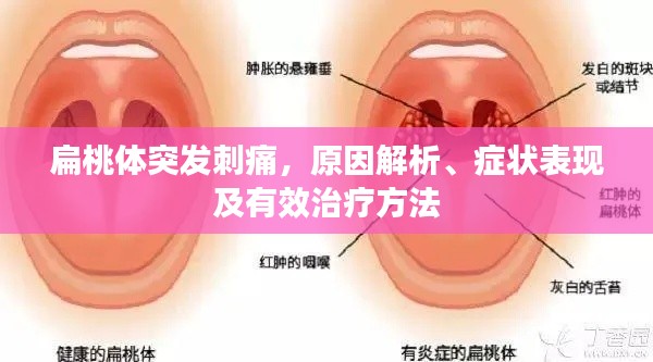 扁桃体突发刺痛，原因解析、症状表现及有效治疗方法