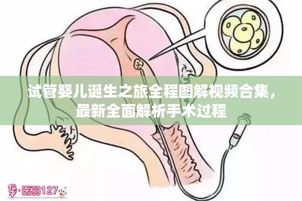 试管婴儿诞生之旅全程图解视频合集，最新全面解析手术过程