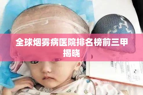 全球烟雾病医院排名榜前三甲揭晓