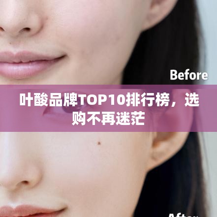 叶酸品牌TOP10排行榜，选购不再迷茫