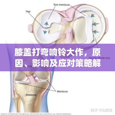 膝盖打弯响铃大作，原因、影响及应对策略解析